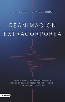 Imagen de REANIMACION EXTRACORPOREA