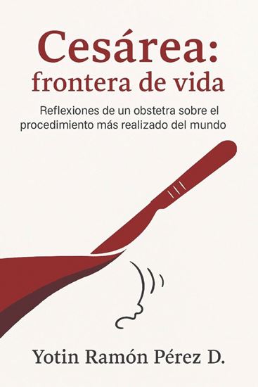 Imagen de CESAREA: FRONTERA DE VIDA